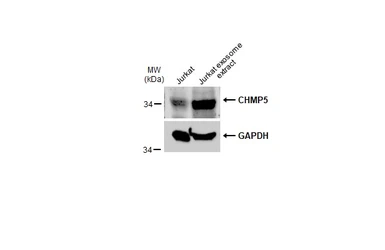 Anti-CHMP5 antibody [N1C3] used in Western Blot (WB). GTX106692