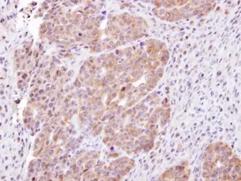Anti-CHMP5 antibody [N1C3] used in IHC (Paraffin sections) (IHC-P). GTX106692