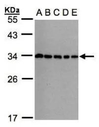 Anti-CHMP5 antibody [N1C3] used in Western Blot (WB). GTX106692