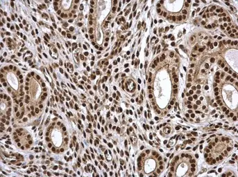 Anti-PSME3 antibody used in IHC (Paraffin sections) (IHC-P). GTX106722
