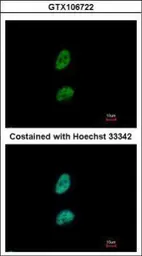 Anti-PSME3 antibody used in Immunocytochemistry/ Immunofluorescence (ICC/IF). GTX106722