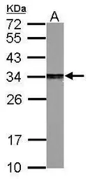Anti-PSME3 antibody used in Western Blot (WB). GTX106722
