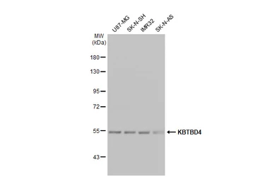 Anti-KBTBD4 antibody used in Western Blot (WB). GTX106777