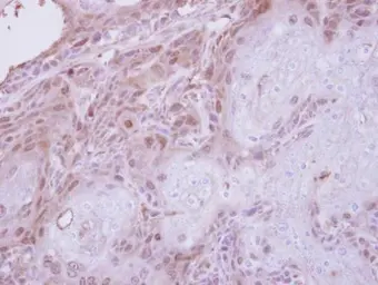 Anti-TPRKB antibody used in IHC (Paraffin sections) (IHC-P). GTX106781