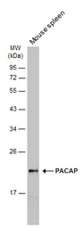 Anti-MZB1?antibody used in Western Blot (WB). GTX106794
