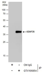 Anti-U2AF1 antibody used in Immunoprecipitation (IP). GTX106854