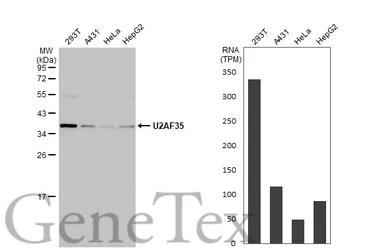 Anti-U2AF1 antibody used in Western Blot (WB). GTX106854
