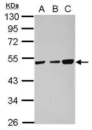 Anti-TXNDC5 antibody used in Western Blot (WB). GTX106914