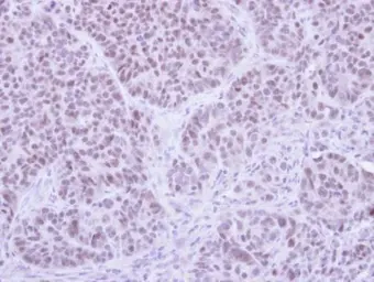 Anti-FHL5 antibody [N1C2] used in IHC (Paraffin sections) (IHC-P). GTX107031