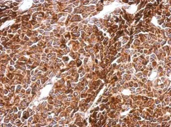 Anti-PHF16 antibody used in IHC (Paraffin sections) (IHC-P). GTX107111