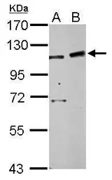 Anti-PHF16 antibody used in Western Blot (WB). GTX107111