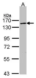 Anti-VCPIP1 antibody [C2C3], C-term used in Western Blot (WB). GTX107169