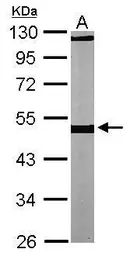 Anti-beta Tubulin antibody used in Western Blot (WB). GTX107175