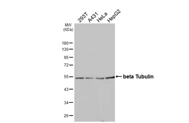 Anti-beta Tubulin antibody used in Western Blot (WB). GTX107175