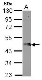 Anti-FBXO4 antibody used in Western Blot (WB). GTX107178