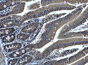 Anti-ALDH1B1 antibody used in IHC (Paraffin sections) (IHC-P). GTX107279