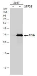 Anti-TFIIB antibody [N1C3] used in Western Blot (WB). GTX107327