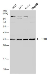Anti-TFIIB antibody [N1C3] used in Western Blot (WB). GTX107327