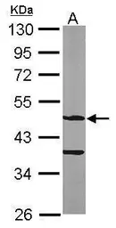 Anti-ASB4 antibody [N1C3] used in Western Blot (WB). GTX107345