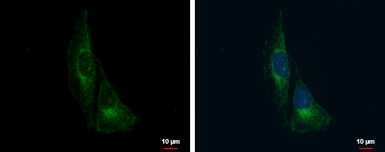 Anti-TrkC antibody used in Immunocytochemistry/ Immunofluorescence (ICC/IF). GTX107385