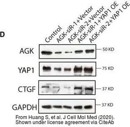 Anti-Acylglycerol kinase antibody used in Western Blot (WB). GTX107413