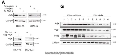Anti-Acylglycerol kinase antibody used in Western Blot (WB). GTX107413