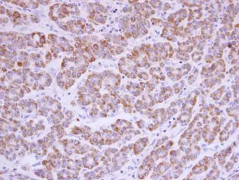 Anti-Acylglycerol kinase antibody used in IHC (Paraffin sections) (IHC-P). GTX107413