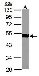 Anti-Acylglycerol kinase antibody used in Western Blot (WB). GTX107413
