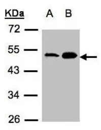 Anti-Acylglycerol kinase antibody used in Western Blot (WB). GTX107413