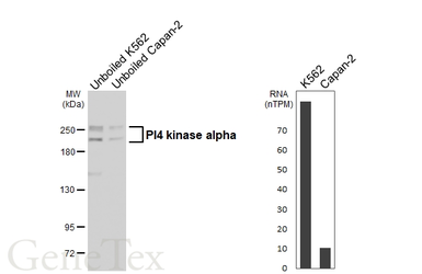 Anti-PI4 kinase alpha antibody [C1C2], Internal used in Western Blot (WB). GTX107441