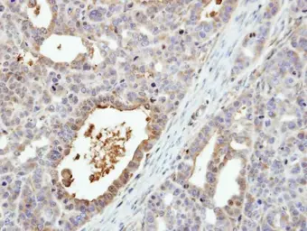Anti-MEK6 antibody [N1C3] used in IHC (Paraffin sections) (IHC-P). GTX107445