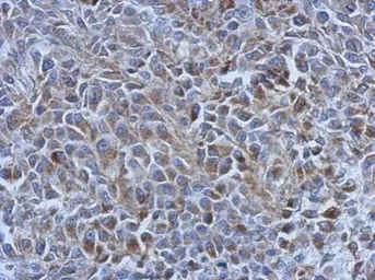 Anti-Adenylate kinase 4 antibody [N1C3-2] used in IHC (Paraffin sections) (IHC-P). GTX107482