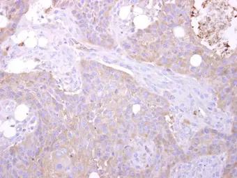 Anti-MST3 antibody [N1C1] used in IHC (Paraffin sections) (IHC-P). GTX107500