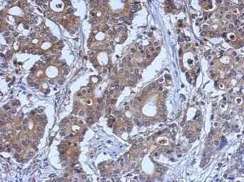 Anti-LYK5 antibody used in IHC (Paraffin sections) (IHC-P). GTX107557