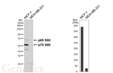 Anti-p70 S6K antibody used in Western Blot (WB). GTX107562