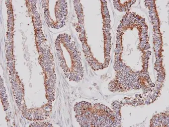Anti-Glycerol kinase 2 antibody [N1C1-3] used in IHC (Paraffin sections) (IHC-P). GTX107563