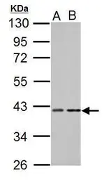 Anti-PKA C alpha antibody used in Western Blot (WB). GTX107567