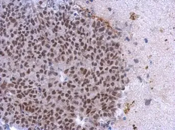 Anti-Casein Kinase 2 alpha antibody used in IHC (Paraffin sections) (IHC-P). GTX107576