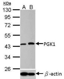 Anti-PGK1 antibody used in Western Blot (WB). GTX107614
