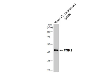 Anti-PGK1 antibody used in Western Blot (WB). GTX107614