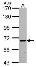 Anti-COASY antibody used in Western Blot (WB). GTX107623
