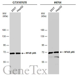 Anti-NFkB p65 antibody used in Western Blot (WB). GTX107678