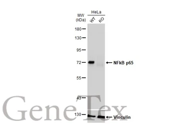 Anti-NFkB p65 antibody used in Western Blot (WB). GTX107678