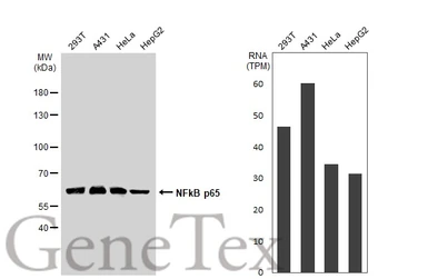 Anti-NFkB p65 antibody used in Western Blot (WB). GTX107678
