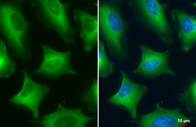 Anti-PKM antibody used in Immunocytochemistry/ Immunofluorescence (ICC/IF). GTX107681