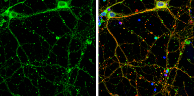 Anti-SHANK1 antibody [C3], C-term used in Immunocytochemistry/ Immunofluorescence (ICC/IF). GTX107701