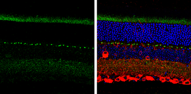 Anti-SHANK1 antibody [C3], C-term used in IHC (Paraffin sections) (IHC-P). GTX107701