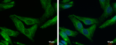 Anti-SHANK1 antibody [C3], C-term used in Immunocytochemistry/ Immunofluorescence (ICC/IF). GTX107701