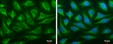 Anti-OSBPL6 antibody [C3], C-term used in Immunocytochemistry/ Immunofluorescence (ICC/IF). GTX107723