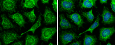 Anti-TOMM7 antibody [N1C3] used in Immunocytochemistry/ Immunofluorescence (ICC/IF). GTX107731